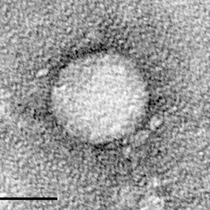 Hepatitis C virus